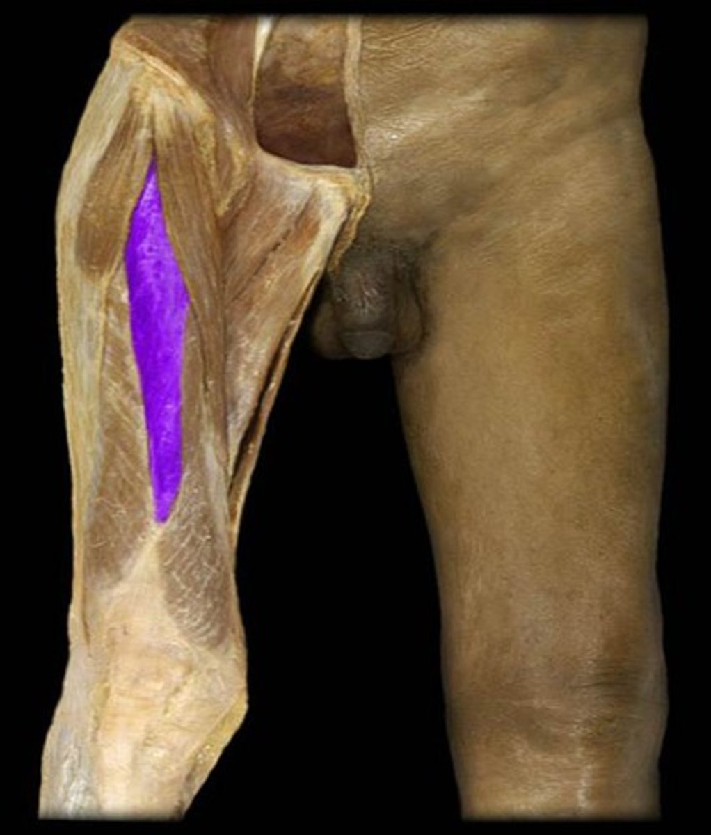 <p>What is the name of this muscle, highlighted in purple?</p>