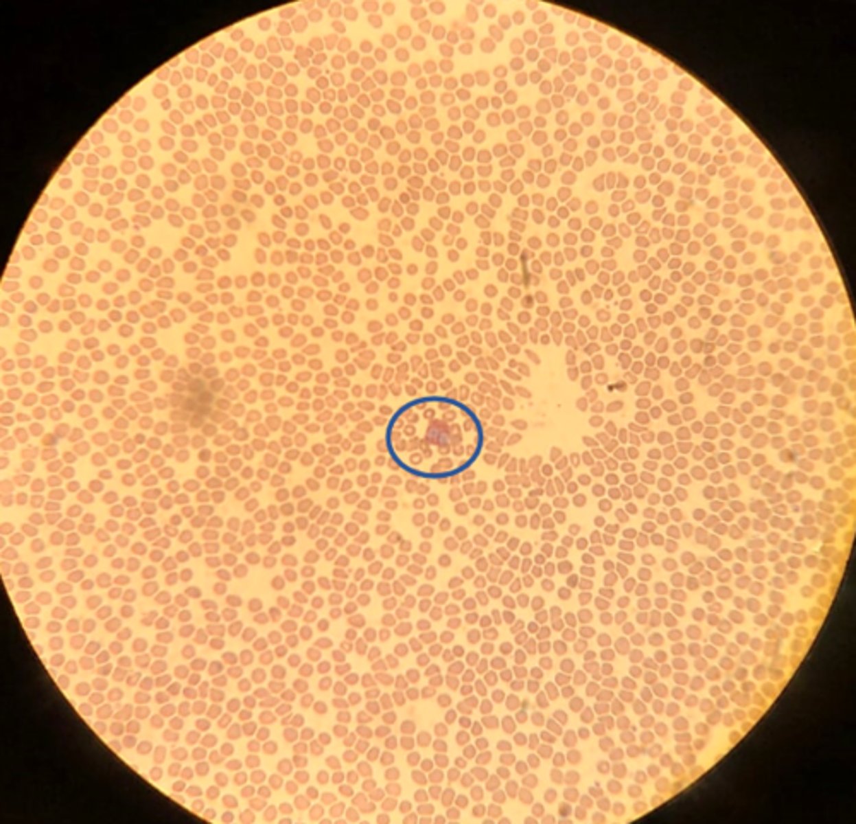 <p>Name the white blood cell</p>