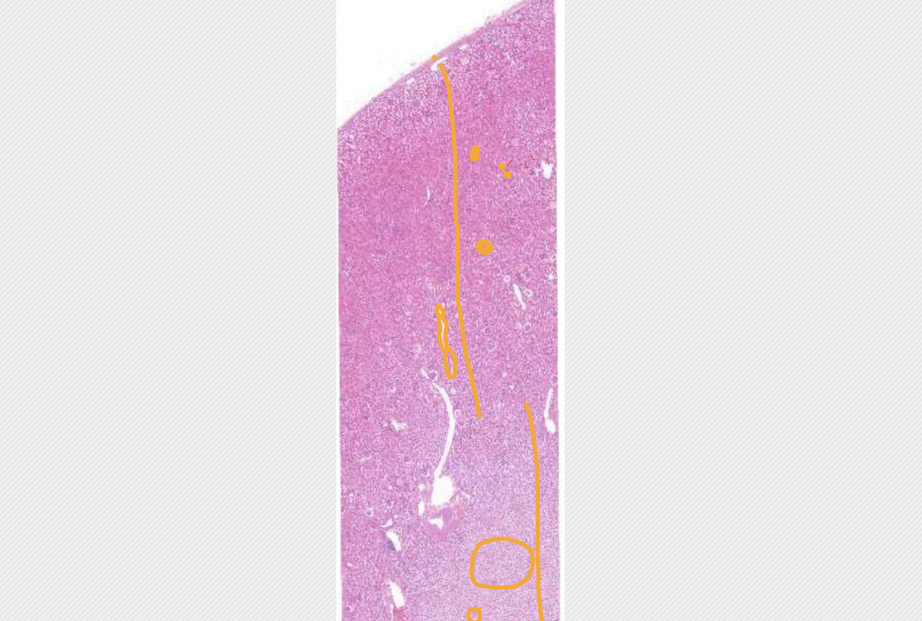 <p>overall morphology of the kidney (large lagnification)</p>