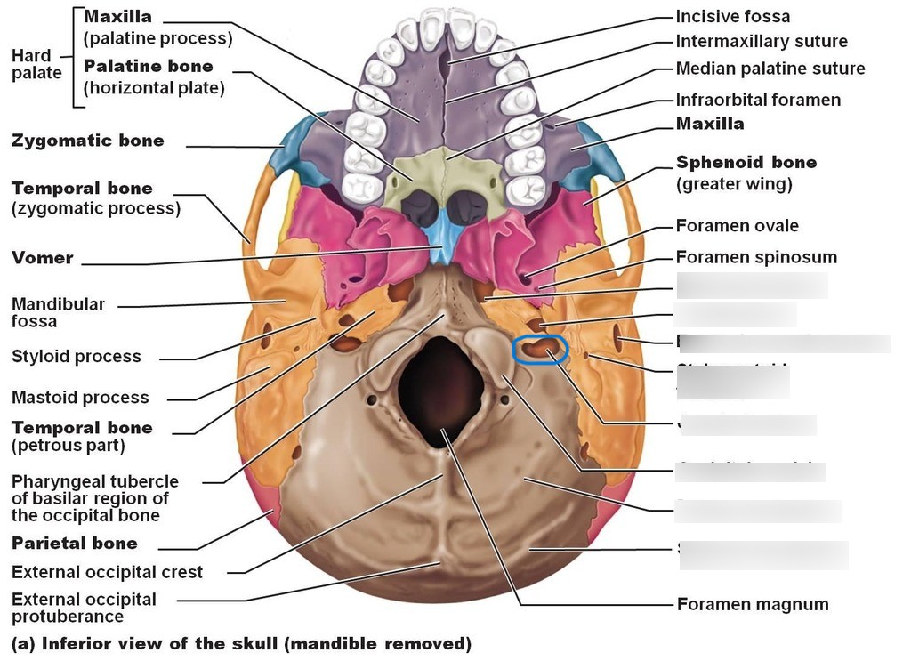 <p>What part of the skull?</p>