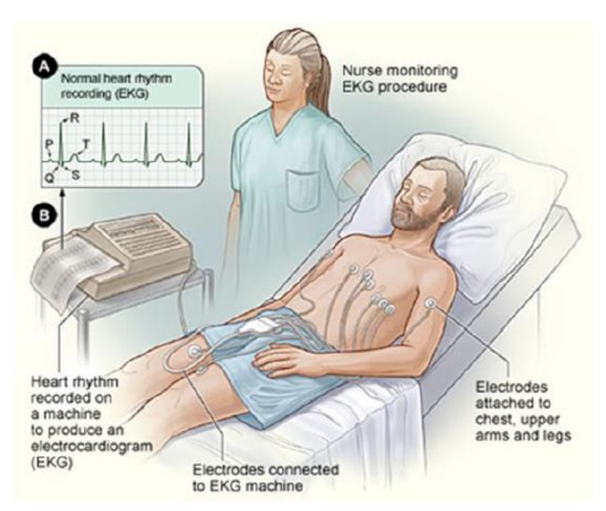 <p>Used to measure rhythms of the heart by producing a record of electrical activity:</p><ul><li><p>rhythm is caused by spread of a wave of electrical activity (depolarisation) through specialised tissue within the heart</p></li><li><p>causes tiny electrical changes on the surface of the skin that can be measured with 12 electrodes</p></li></ul><p></p>