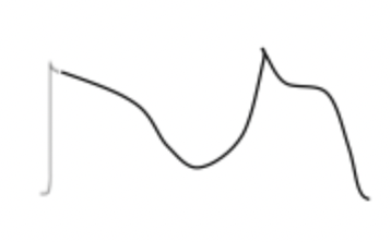 <p>what currents are normal in EAD? how about abnormal?.</p><p><mark>COME BACK TO THIS .</mark></p>