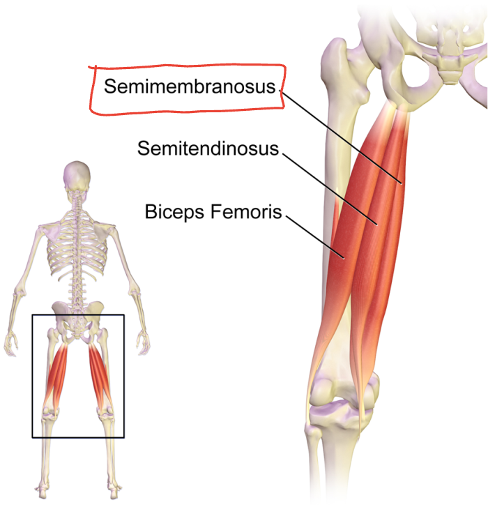 What is this muscle?