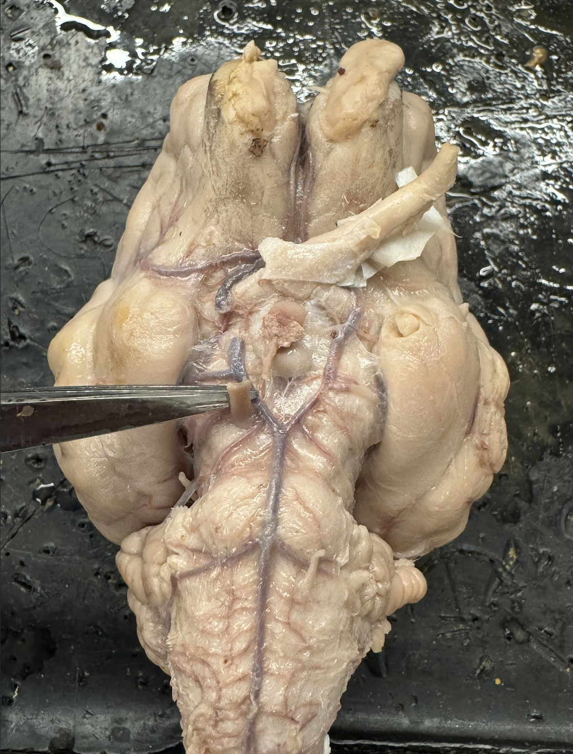 <p>what nerve is this?</p>