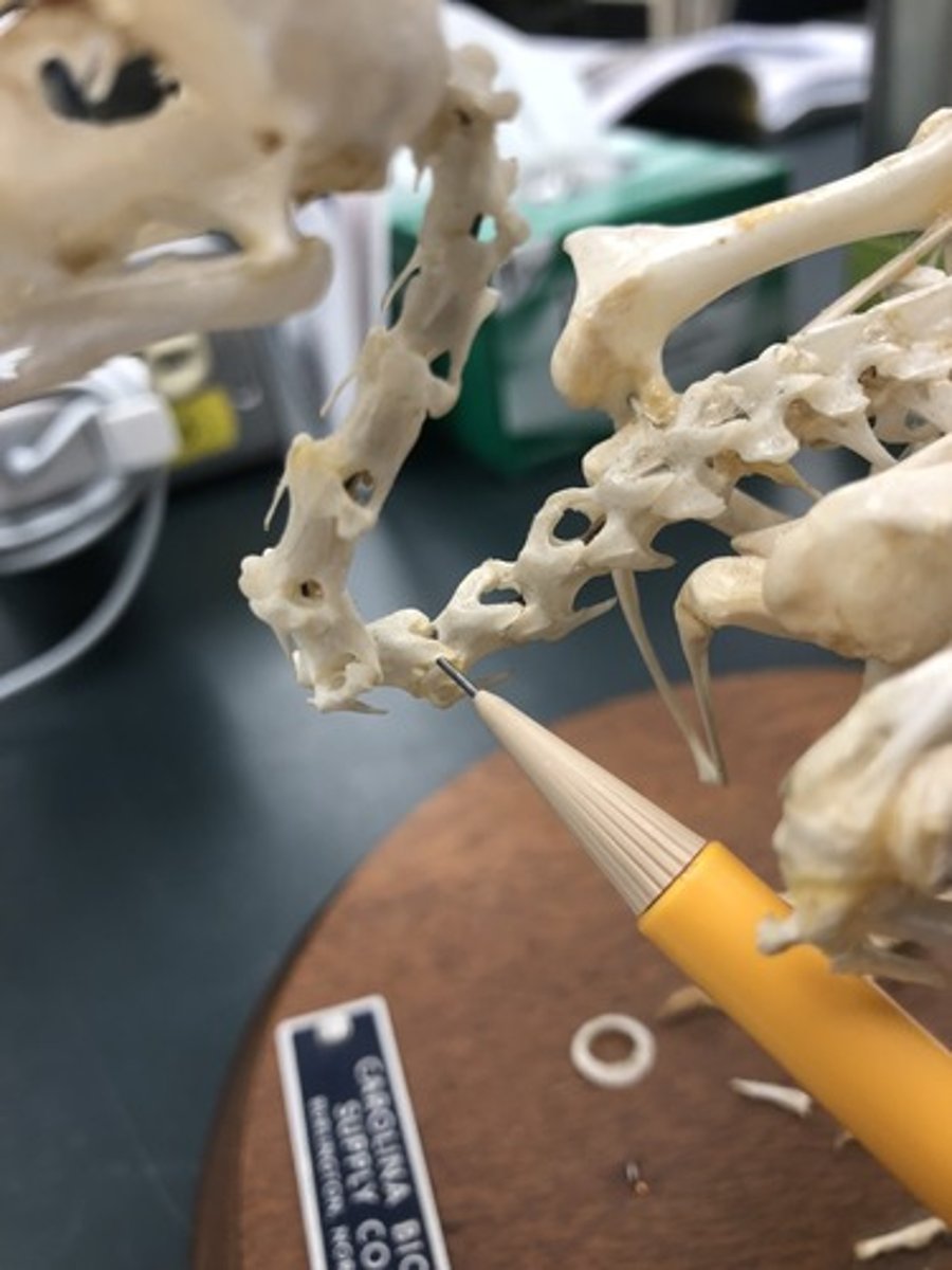 <p>the neck</p>