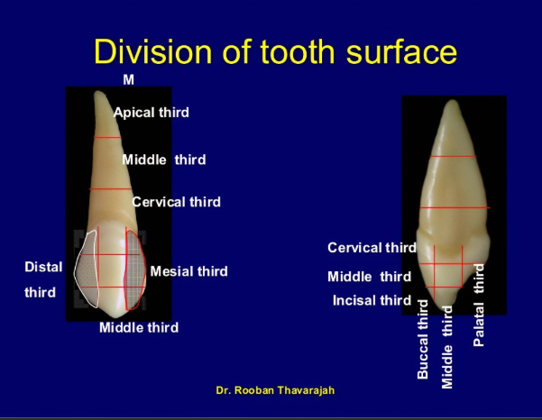 <p>Mesial contact - near junction of buccal and middle third</p><p>Distal contact - middle third</p>