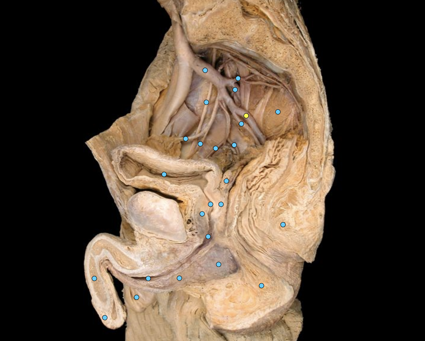 term image
