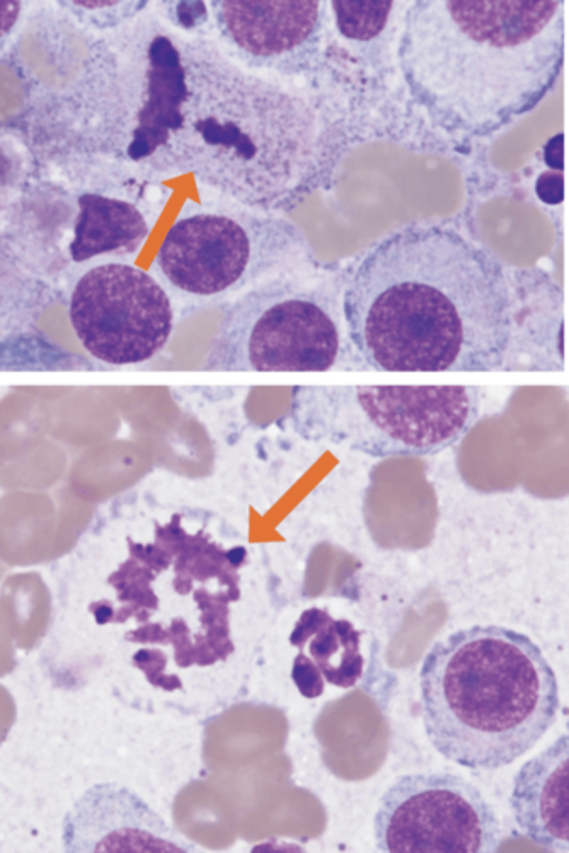 <p>What abnormal features do you note about these cells?</p>