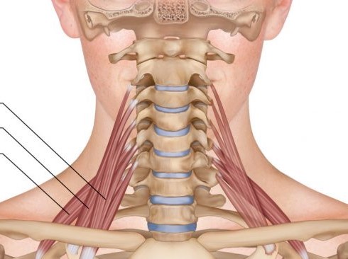 <p>Origin: transverse processes of cervical vertebrae Insertion: anterolaterally on first two ribs Action: Elevate first two ribs</p>