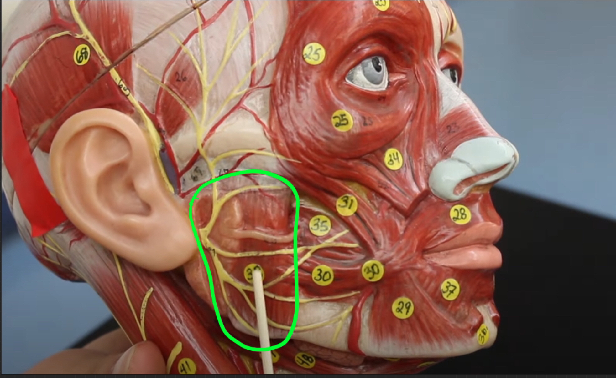 term image