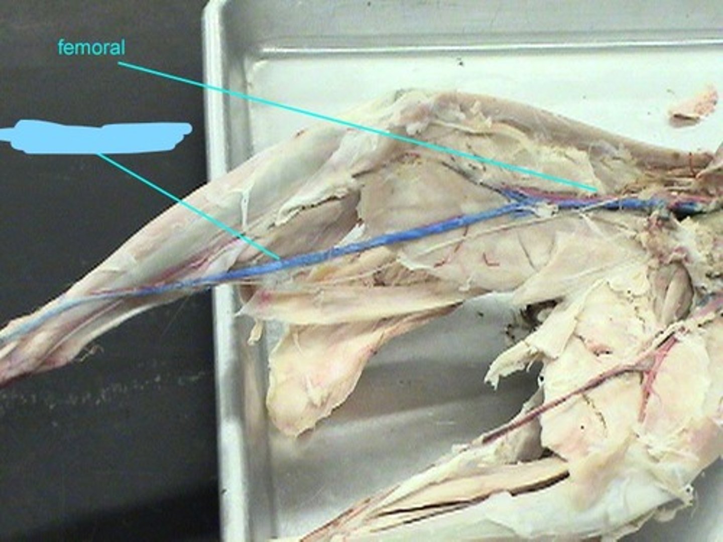 <p>nerve in this cluster</p>