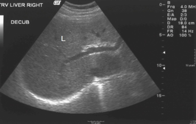 What is the texture of this liver?