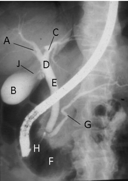 <p>What contrast procedure was performed to produce this image?</p><p>Identify A – H:</p>