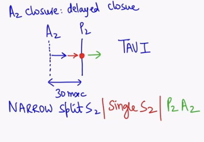 <p>S2 = A2P2</p><ul><li><p>first A2 close and the P2 closes</p></li><li><p>In aortic stenosis, A2 is delaying as per condition</p></li><li><p>This will cause narrowing of s2 / narrow splitting S2</p></li><li><p>In severe cases, single S2 is heard and sometimes P2A2 (reverse splitting) can also heard</p></li><li><p>Severity depend on time ( early - narrow splitting, late - single s2, severe - reverse splitting )</p></li></ul><p></p>