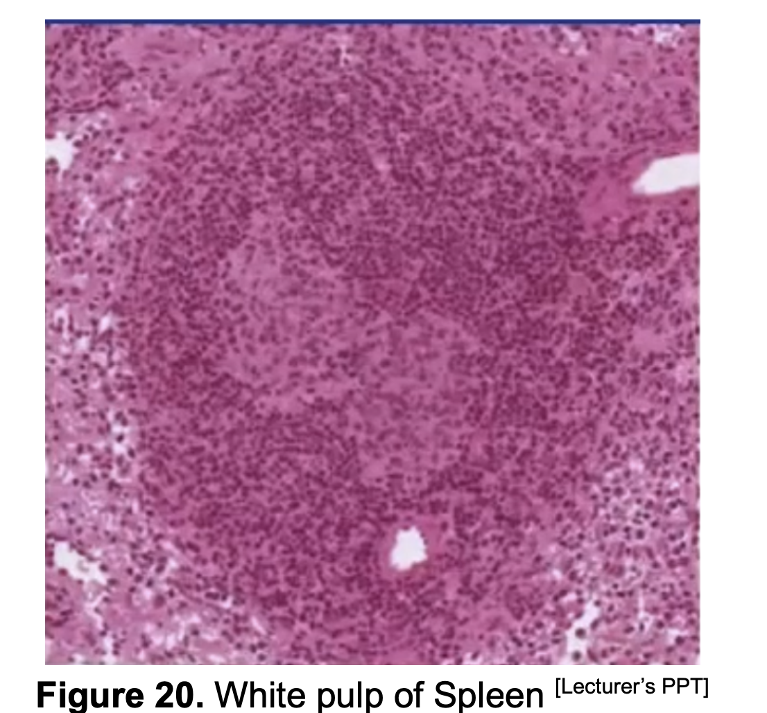 <p><strong>WHITE PULP&nbsp;</strong></p>