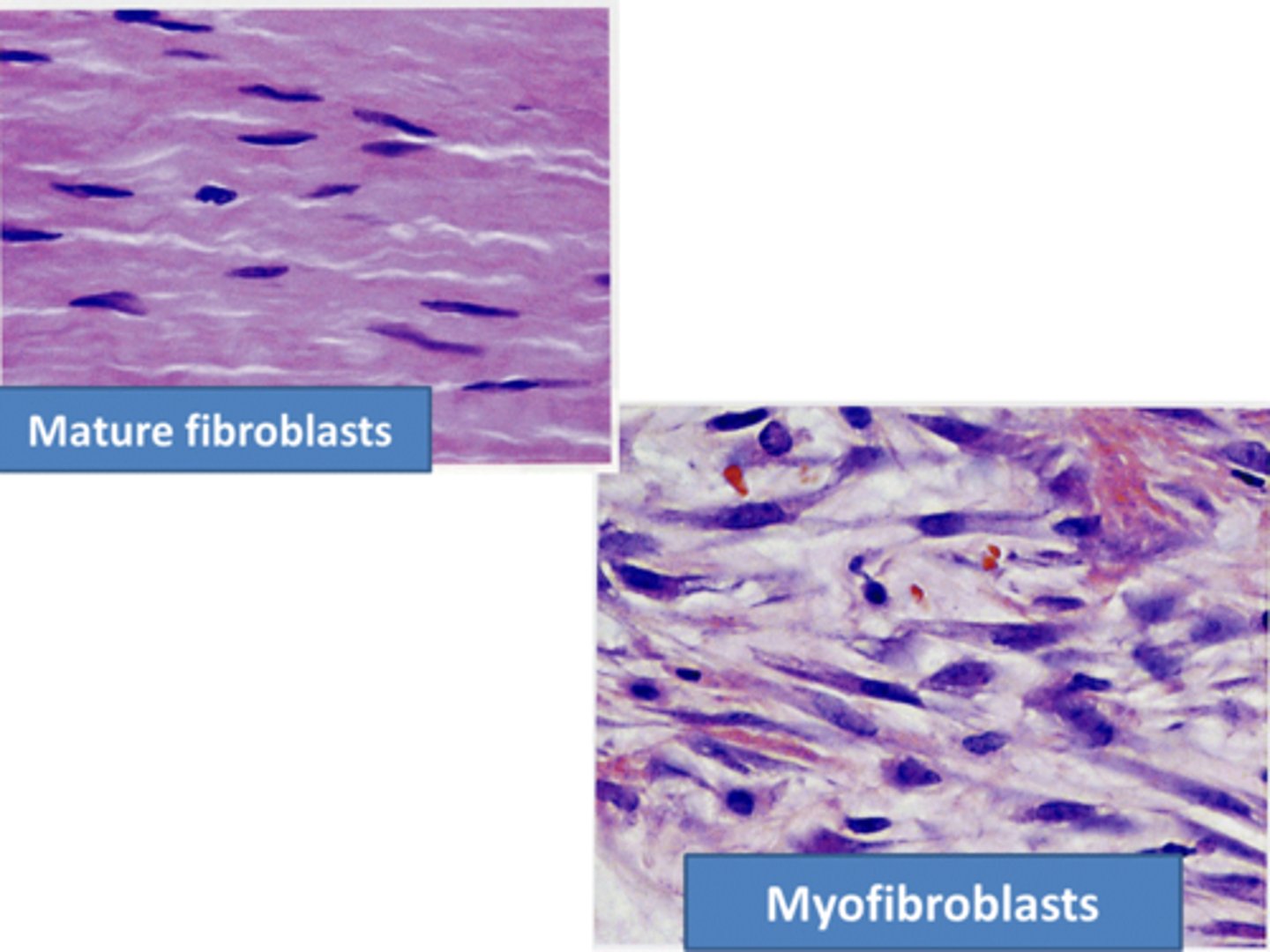 <p>Cells that play a role in wound healing and fibrosis in the liver.</p>