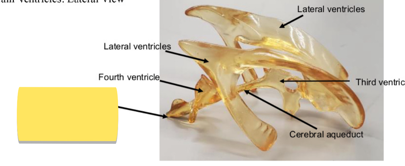 <p>Name this brain ventricle</p>