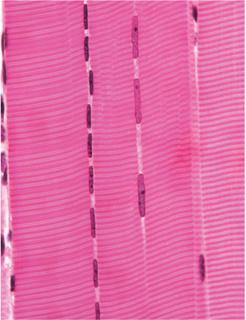 striated, voluntary, multi nucleated 

attached to bones of skeleton (movement of body in relation to external environment)