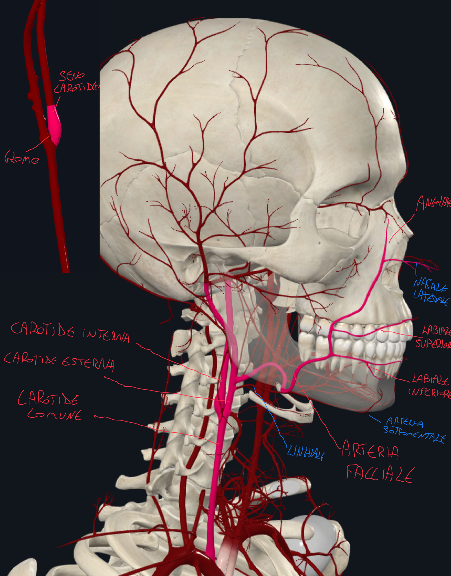 <p>CAROTIDE COMUNE:</p><ul><li><p>A dx origina dal tronco brachiocefalico, mentre a&nbsp;sx origina dall’arco aortico</p></li><li><p>Risale verticalmente nel collo fino al livello del margine superiore della cartilagine tiroidea (pomo d’Adamo o a livello della C4) dove biforca in una CAROTIDE INTERNA ED ESTERNA</p></li><li><p>Quella interna sale verso l’encefalo senza emettere ramificazioni nel collo, mentre quella esterna emette rami, tra cui l’ARTERIA FACCIALE</p></li><li><p>A livello della biforcazione, in associazione alla carotide interna, osserviamo dei rigofiamenti, cioè il Seno Carotideo (barocettore per la PA) e il Glomo Carotideo (chemiocettore per le concentrazioni di gas) che sono in questa posizione strategica perché e la carotide interna che irrora la cavità cranica</p></li></ul><p>ARTERIA FACCIALE:</p><ul><li><p>Decorso → carotide esterna → prosegue dietro l’angolo della mandibola → ne scavalca il margine inferiore del corpo e risale obliquamente fino all’angolo mediale dell’occhio</p></li><li><p>In questo, emette dei rami tra cui → l’arteria labiale inferiore, superiore e l’arteria angolare per vascolarizzare tessuti moli e strutture superficiali del viso (la angolare raggiunge fino la radice del naso e comunica con rami oftalmici → anastomosi carotide interna ed esterna).</p></li><li><p>E’ possibile palparne la pulsazione quando supera la mandibola in corrispondenza del margine anteriore del massetere</p></li></ul><p></p><p></p><p></p>