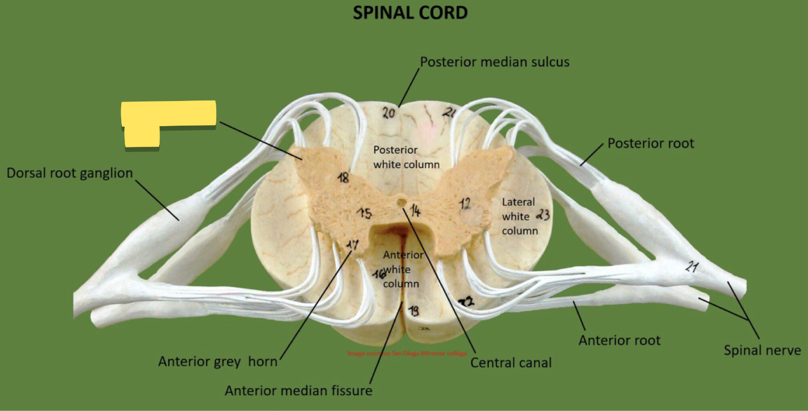 <p>Name this spinal cord part</p>