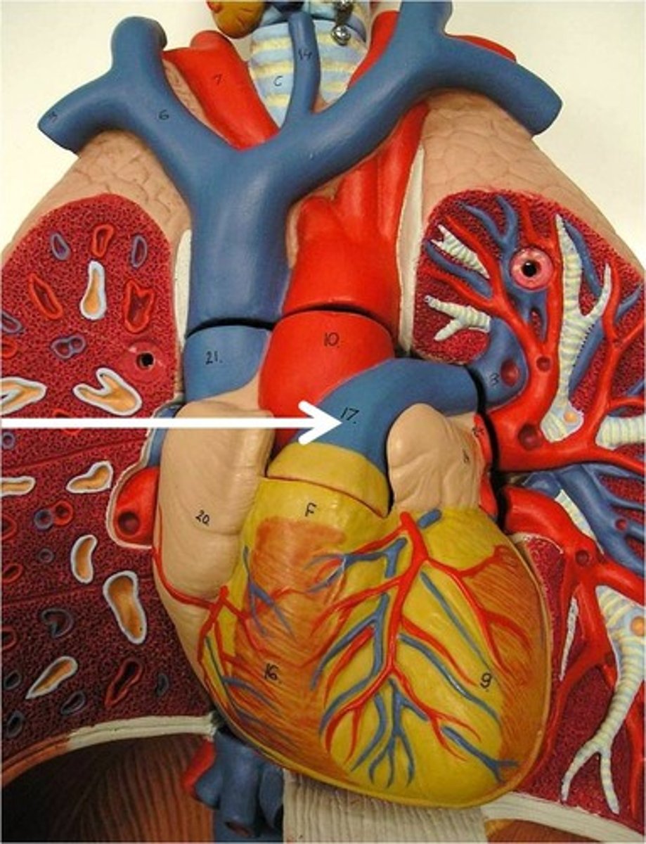 <p>Name the blood vessel.</p>