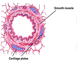 <p><strong>Intra pulmonary bronchus</strong></p>