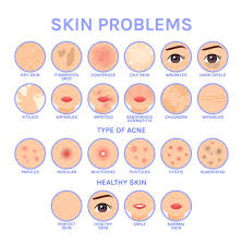 <p>skin condition</p>