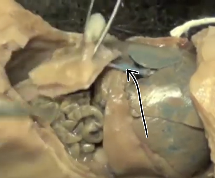 <p>What is this?</p>