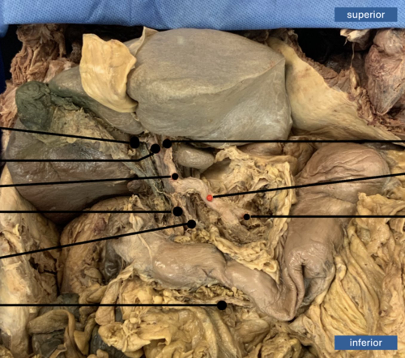 <p>artery</p>