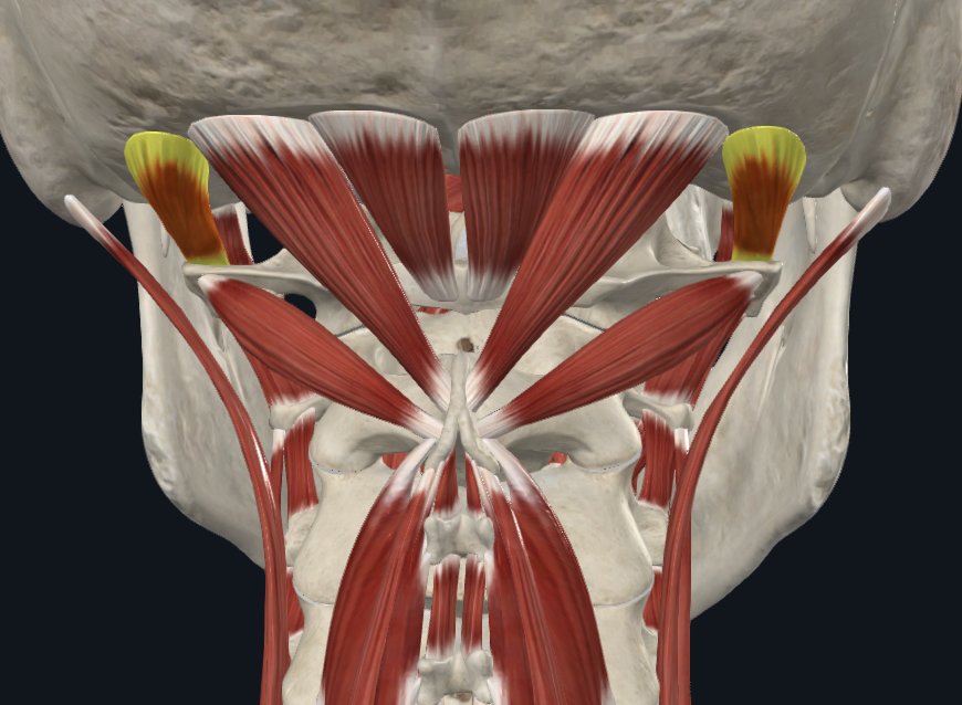 <p><strong>Nombre alterno: </strong>Oblicuo superior</p><p><strong><mark data-color="yellow" style="background-color: yellow; color: inherit">Origen: </mark></strong><mark data-color="yellow" style="background-color: yellow; color: inherit">Apófisis transversa del atlas(C1)</mark></p><p><strong><mark data-color="blue" style="background-color: blue; color: inherit">Inserción: </mark></strong><mark data-color="blue" style="background-color: blue; color: inherit">Tercio externo de línea nucal inferior</mark></p><p><strong><mark data-color="red" style="background-color: red; color: inherit">Acción: </mark></strong><mark data-color="red" style="background-color: red; color: inherit">Lateralización y rotación de la cabeza</mark></p><p><strong><mark data-color="purple" style="background-color: purple; color: inherit">Inervación: </mark></strong><mark data-color="purple" style="background-color: purple; color: inherit">Plexo braquial</mark><strong><br><mark data-color="green" style="background-color: green; color: inherit">Relaciones: </mark></strong><mark data-color="green" style="background-color: green; color: inherit">X</mark></p><p><strong>Notas:</strong></p><p>No tan oblicuo</p>
