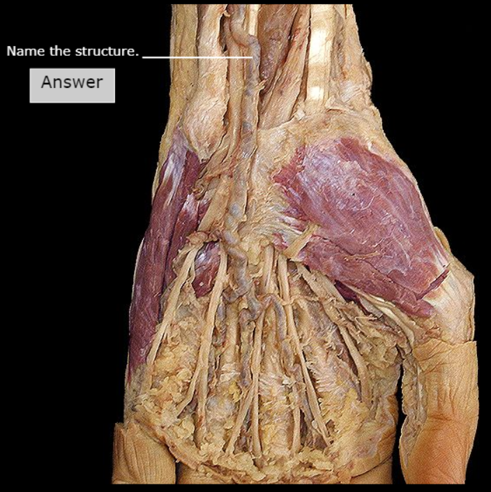 <p>What artery is this</p>