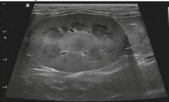 <p>what view is this ultrasound of the kidneys?</p>