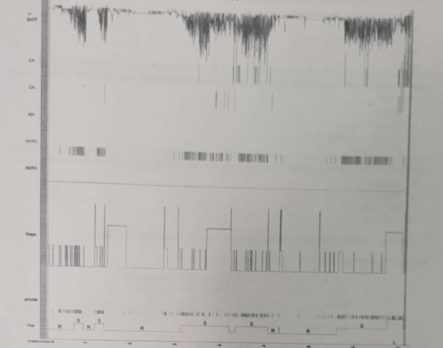 <p>What <span>does this raw data trend report indicate?</span></p>