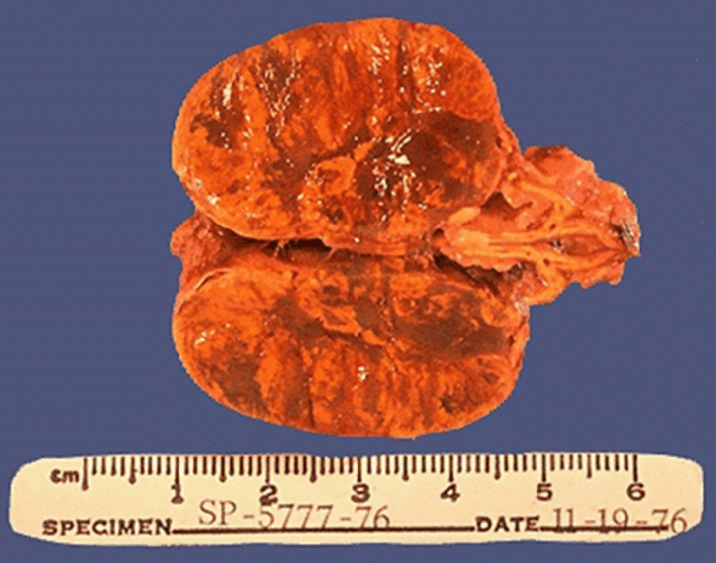 <p>Identify the pathology</p>