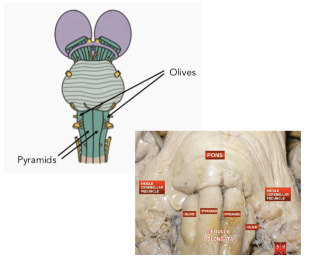 <p>Anatomy of MO: Olives</p>