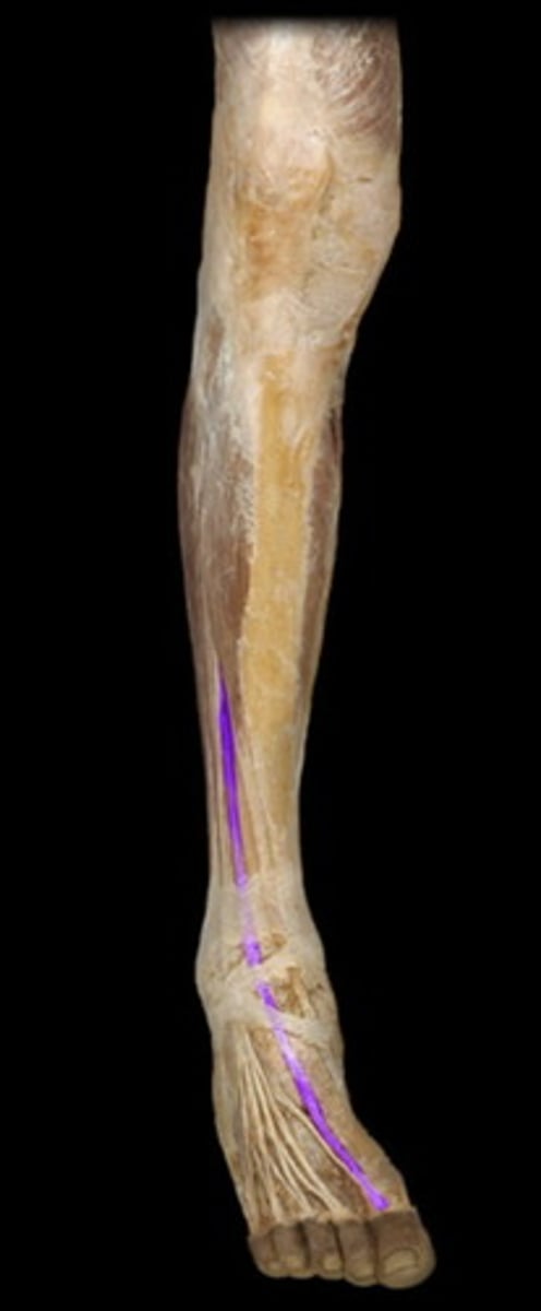 <p>extensor hallucis longus</p>