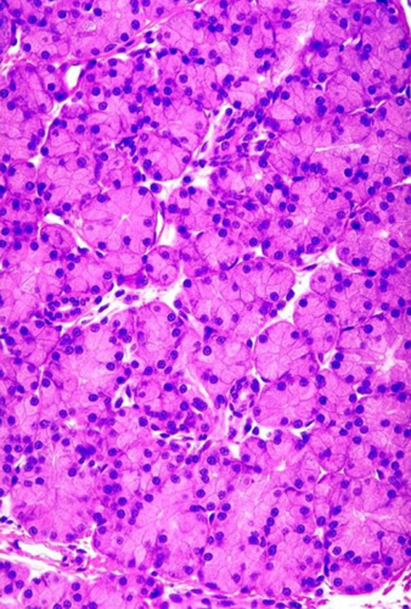 <p>serous</p><p>- this is from the parotid gland</p><p>- note: no mucous tubule cells (all cells are well-stained with perfectly round nuclei)</p>