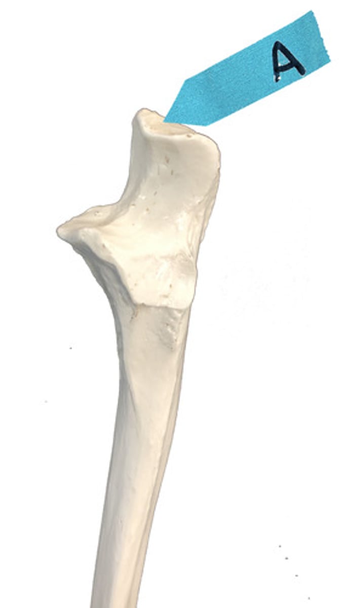 <p>Identify this bone marking.</p>