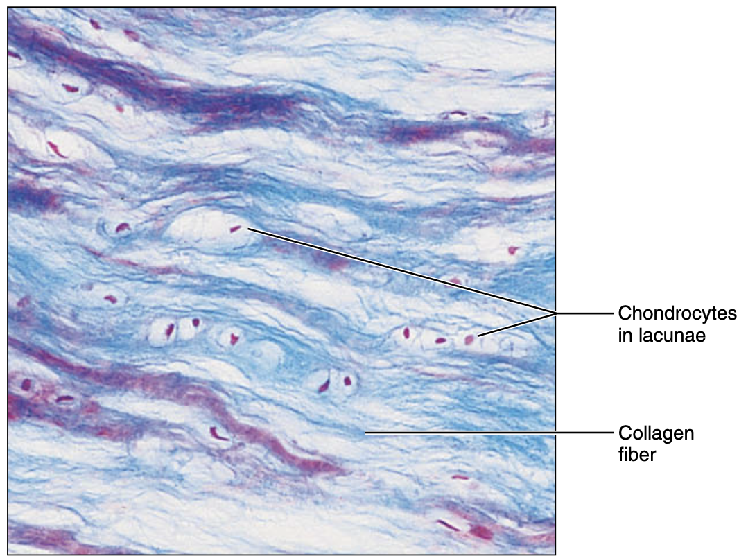 <p>fibrocartilage</p>