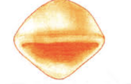 <p>rhomboidal </p>