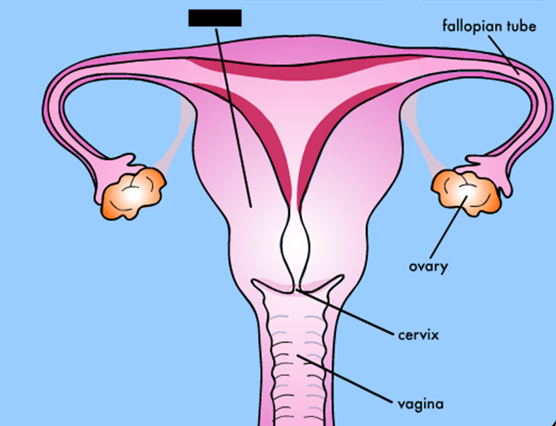 term image