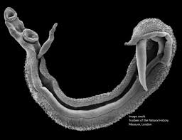 <p>Caused by: small flukes Schistosoma (Schistosoma mansoni) helminth </p><p>vector: feces or urine ( contaminated water ) </p><ul><li><p>have definitiev and intermidet host </p><ul><li><p>human =defintive </p></li><li><p>water snails = intetmidet </p></li></ul></li><li><p>need both male and female </p></li><li><p>We are exposed to the cerciea </p><ul><li><p>can cross the skin </p></li><li><p>fish like tail </p></li></ul></li><li><p>can cause damage to the liver </p><ul><li><p>potbelly </p></li><li><p>can log into the blood tissues, causing granulomas </p><p></p></li></ul></li></ul><p></p>