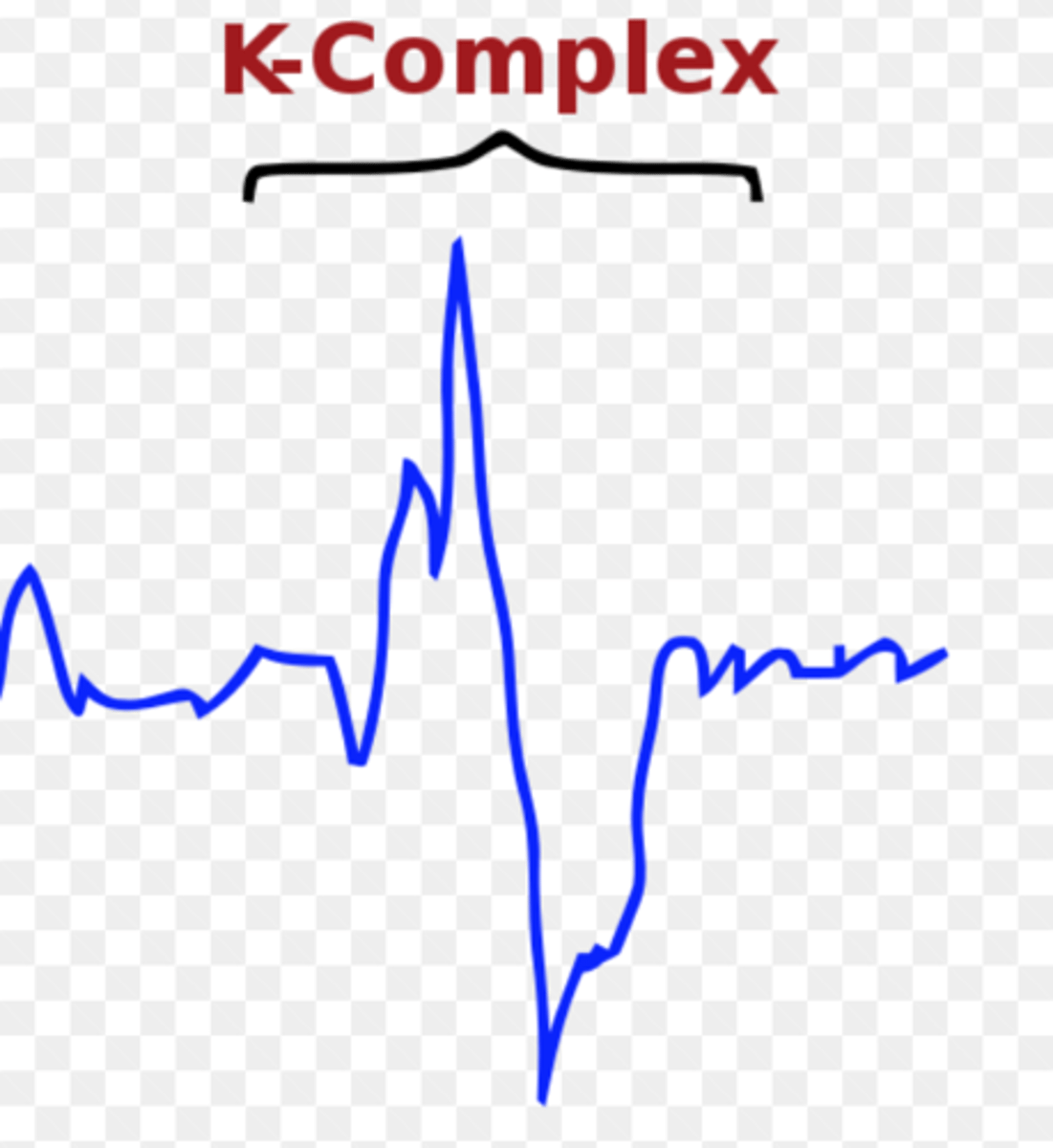 <p>(A) K-Complexes</p><p>K-Complexes refer to a type of brain activity that suppresses cortical arousal, while also helping sleep based memory formation.</p>