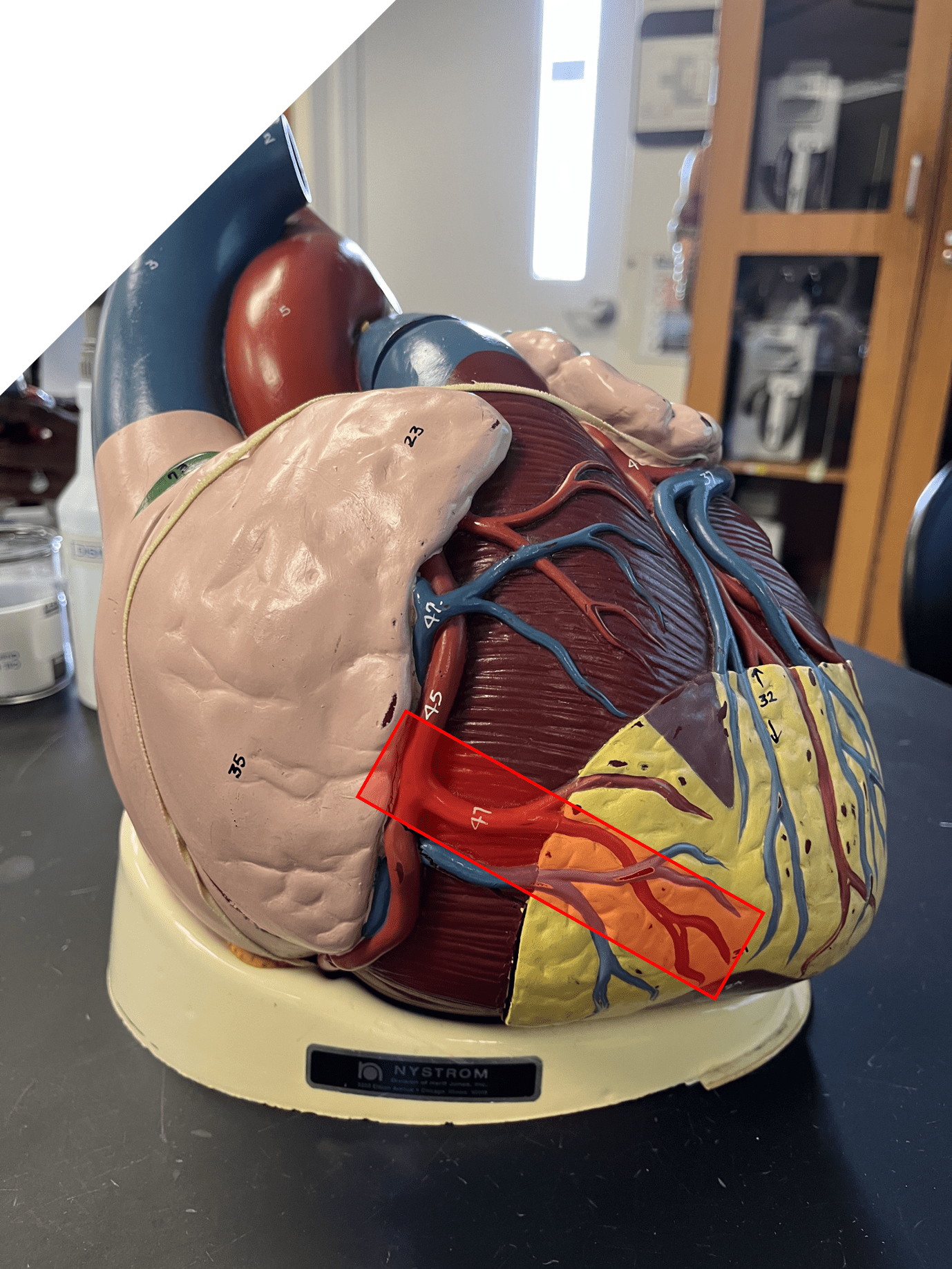 • Part of the coronary circulation.

• Supplies the lateral right side of the heart moving toward the apex.

• One of the branches of the right coronary artery.