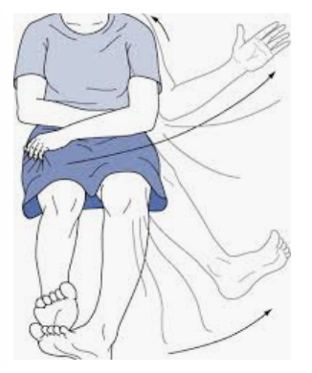 <p>A movement disorder caused by damage to the subthalamus, characterized by violent, flinging movements of the extremities.</p>