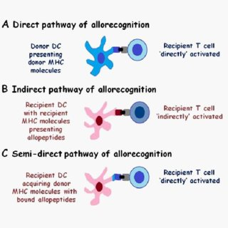 <p>Recipient T cells recognise intact HLA molecules alone and/or peptide:MHC complexes on donor DCs</p>