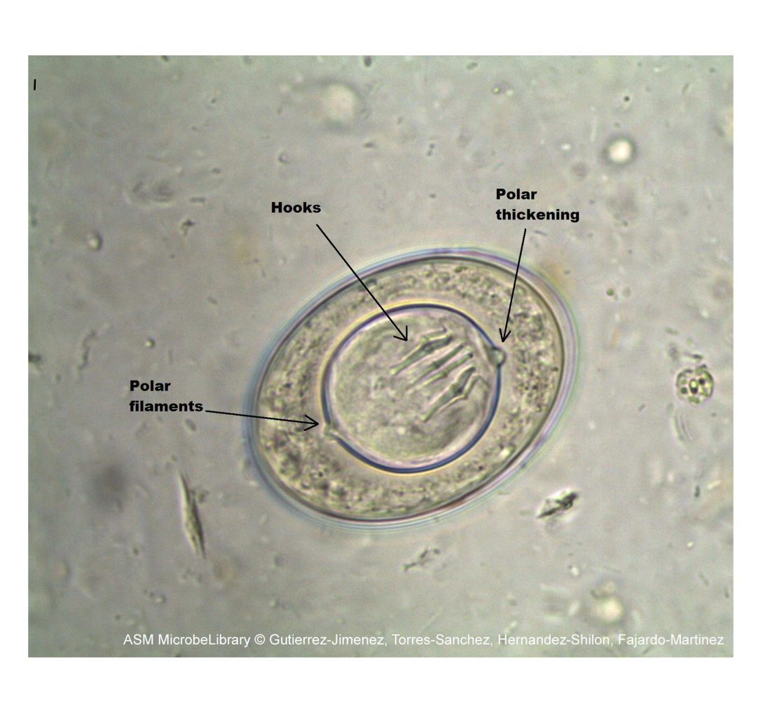 <p>What does the Hymenopis nana (egg form) look like?</p>