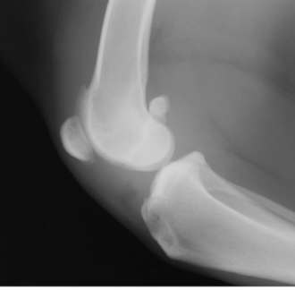 <p>What condition? What main feature does the image show? </p>