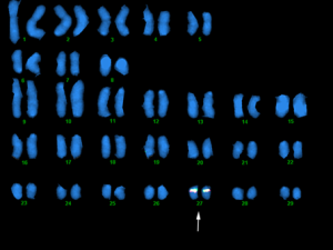 - costs $50 to test 50,000 SNP's
- certain SNP's are favorable to others
- genetics are used to determine phenotypic variability
- bovine genome consists of billions of base pairs