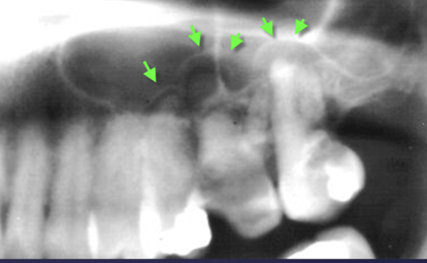 <p>What are the arrows pointing to?</p>